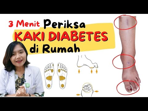 3 MENIT PERIKSA KAKI DIABETES DI RUMAH | dr.Emasuperr