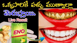 🔥పసుపుగా మారిన -గార పట్టిన పళ్ళు 2 నిమిషాల్లో తెల్లగా మారిపోతాయి  ఈ చిట్కా మిస్ అవ్వకండి💯👍
