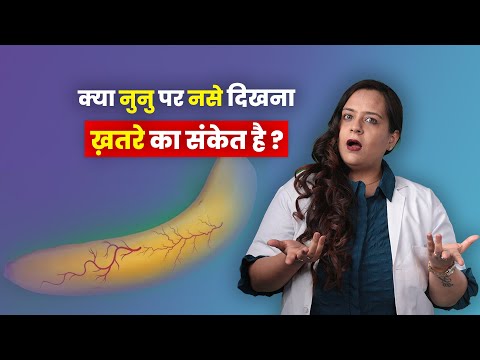 क्या नसे दिखना नुनु पर ख़तरे का संकेत है ? || IN HINDI || DR NEHA MEHTA