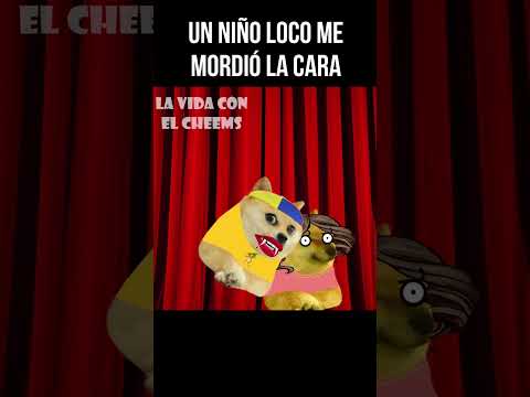 NIÑO CON DERECHO me muerde LA CARA #shorts
