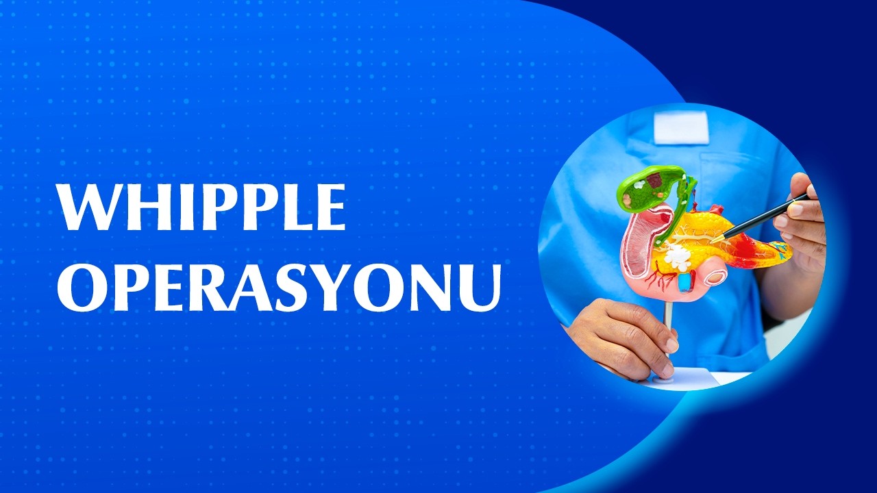 Whipple Ameliyatı Nedir? Nasıl Yapılır?