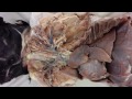Aortic Arch and Related Arteries