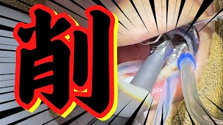 歯医者に通院できない事態に！？お口の中は！？
