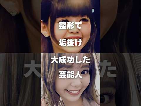 整形で垢抜けた芸能人まとめ第2弾|美容法とメイクの進化例 サムネイル