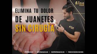 Cómo eliminar el dolor de juanete con fisioterapia y ejercicios, SIN CIRUGÍA