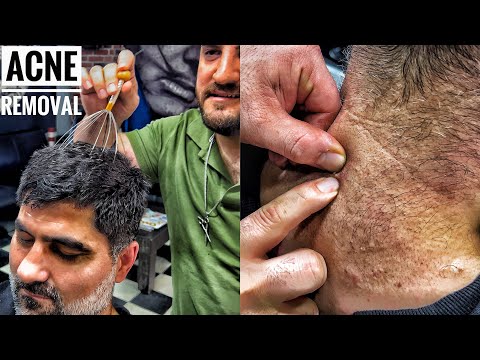 ASMR Head Massage from Turkish Barber • shoulder, arm, knuckle cracking, hair, neck