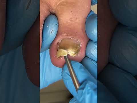 Satisfying pedicure video! #pedicure