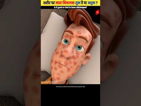 рд╢рд░реАрд░ рдкрд░ рдорд╛рддрд╛ рдирд┐рдХрд▓рдирд╛ рд╢реБрдн рд╣реИ рдпрд╛ рдЕрд╢реБрдн | Is it good or bad to have Chickenpox | #shorts #dailyfacts