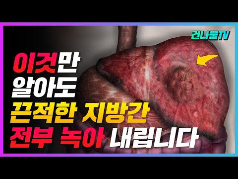 간에 낀 끈적한 지방간 제거 방법 이렇게 해야 간이 살아 납니다.