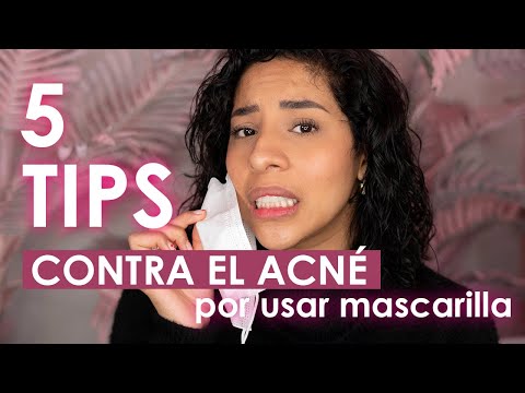 ¿ACNÉ POR MASCARILLA? EVÍTALOS ASÍ - 5 TIPS / Mafer Benites