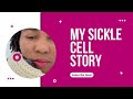 Understanding Sickle Cell Disease