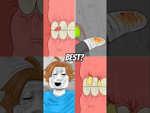😱💀 #roblox​ #memes​ #robloxedit​ #animation​ #comedy​ #robloxshorts​ #cartoon​ #fyp​ #shorts​