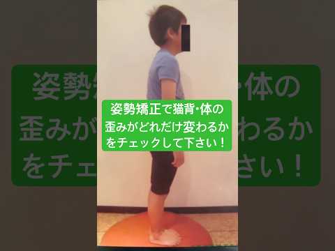 さあ！姿勢矯正で子供の猫背・体の歪みを改善してあげましょう！美容整体きらくや