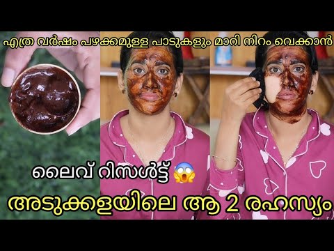 എത്ര വർഷം പഴക്കമുള്ളതാണെങ്കിലും പാടുകളും കലകളും മാറി നിറം വെക്കാൻ അടുക്കള രഹസ്യം skin whitening pack