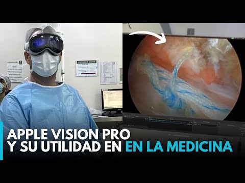 Primera Operación REAL con las APPLE VISION PRO : el futuro de la medicina ya es presente