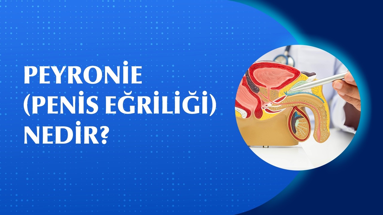 Peyronie Hastalığı (Penis Eğriliği) Nedir? Tedavi Edilebilir mi?