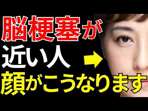【医師監修】見逃すと危険な「脳梗塞が近い人だけに起こる顔の異変」