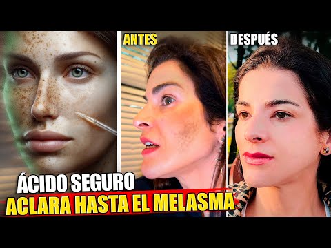 Úsalo para Aclarar Manchas en la Piel, Incluyendo Melasma, manchas en las axilas e ingle