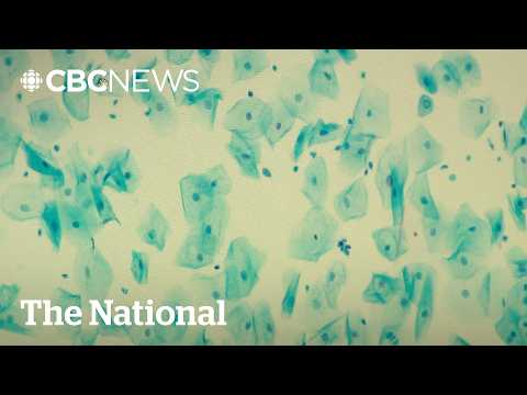 Infections like HPV cause 1 in 8 cancer cases globally: study