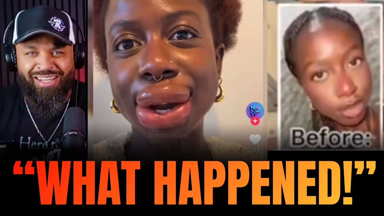 You Won’t Believe What Caused This 🤣