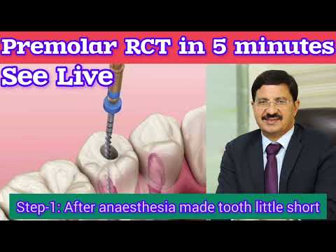 LIVE- Premolar Root Canal (RCT) in just 5 minutes -covered all steps #rct #rootcanaltreatment