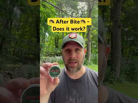 After Bite - Soothing Your Mosquito Bites, Poison Ivy ☠️ And Other Skin Irritations | Does It Work?