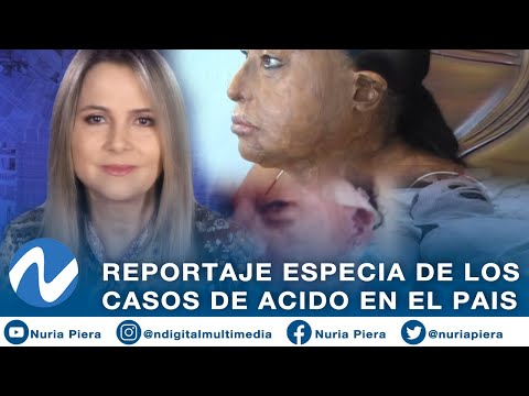 Reportaje especial sobre casos de ácido en el país | Nuria Piera