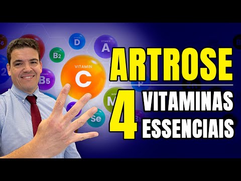 ARTROSE - 4 Vitaminas ESSENCIAIS! 💊