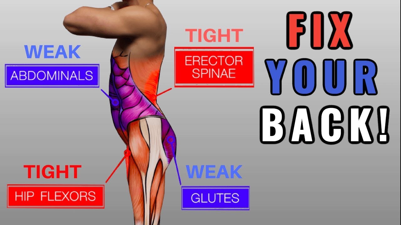 Fix Anterior Pelvic Tilt in 10 Minutes/Day (Daily Exercise Routine)