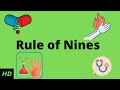 Body Surface Area and Burns