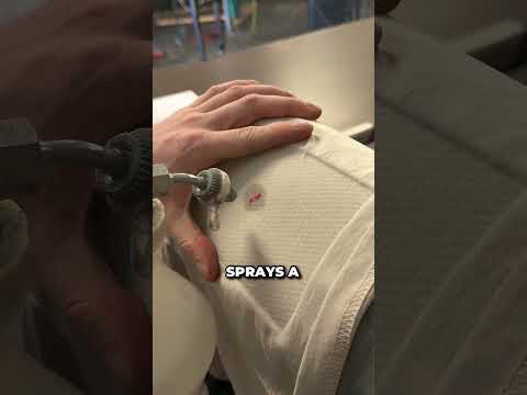 This <strong>Smart</strong> Invention Can Remove Impossible Stains 🤯