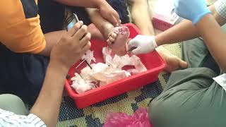 POTONG JARI KAKI