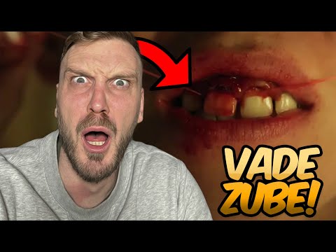 OVA DJECA SEBI VADE ZUBE! 😱 (Ocjenjivanje Strašnih Istinitih Priča)