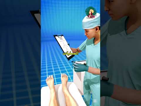 تم بتر قدمة بسبب خطأ طبي!! 😨😱