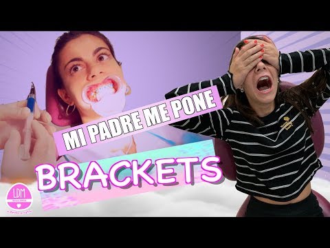Mi padre me pone Brackets y se me CAE UN DIENTE !! 😬 LA DIVERSION DE MARTINA