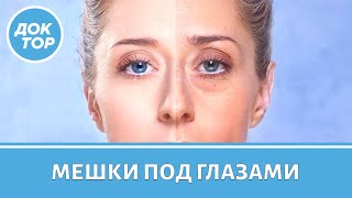 Врач–дерматолог рассказала, как избавиться от мешков под глазами