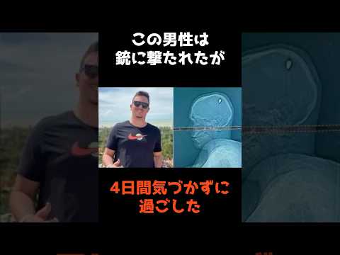 【㊗️200万再生🎉銃に撃たれたが4日間も気づかずに過ごした男】 #shorts #事件