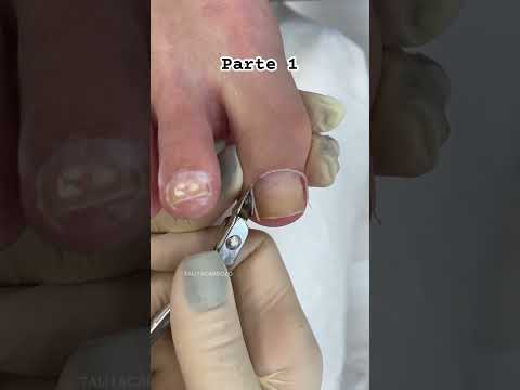 Pedicure passo a passo