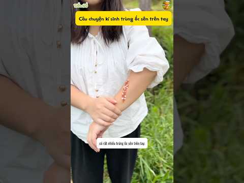 Câu chuyện kí sinh trùng vỏ ốc sên #shorts