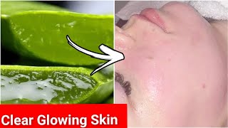 एलोवेरा को इस तरीके से रात में लगाकर सो जाओ सुबह आईने में अपना चेहरा देखकर चौंक जाओगे | Face Glow 
