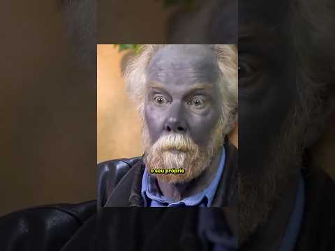 O HOMEM QUE FICOU AZUL ! #curiosidades  #fatosreais #curiosidade #viral #vocesabiavideo