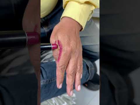 اختبار الرج