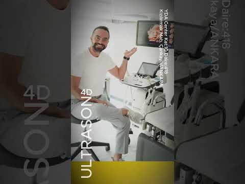 4D ULTRASON #ultrasonography #4dultrasound