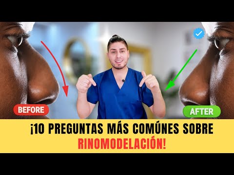 ¿Vale la pena la Rinomodelación? 10 preguntas clave DOCTORLEMUS