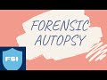 Forensic Medicine and Autopsy Procedures