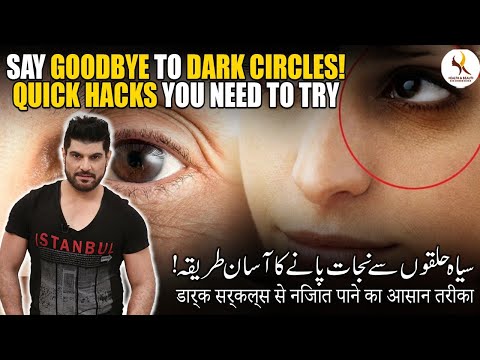 Say Goodbye to Dark Circles! Quick Hacks You Need to Try | Dark Circles Se Nijat Pane Ka Asan Tariqa