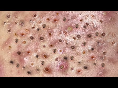 Most Satisfying and Relaxation with An Spa Video #2285
