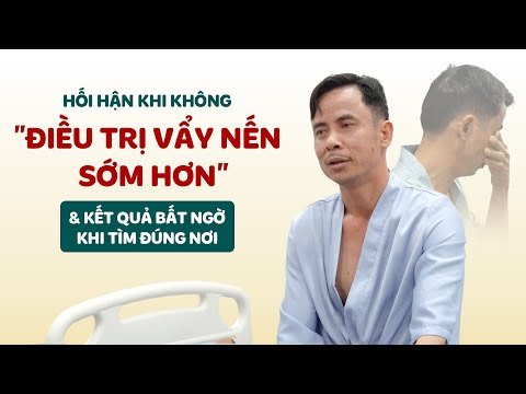 Từng xem nhẹ Vẩy Nến để rồi phải thốt lên "GIÁ NHƯ ĐIỀU TRỊ SỚM HƠN" & Bước ngoặt sau điều trị
