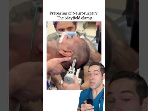 Why this is ESSENTIAL for brain surgery