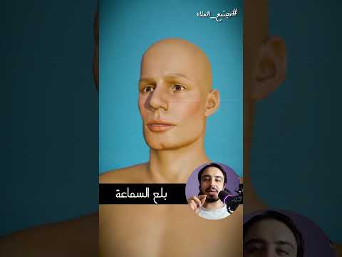 راجل بلع سماعة إيربود ولسه كانت شغالة!